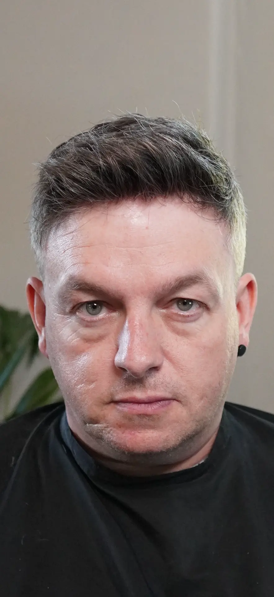 Client after hair replacement at Hair Repair Club