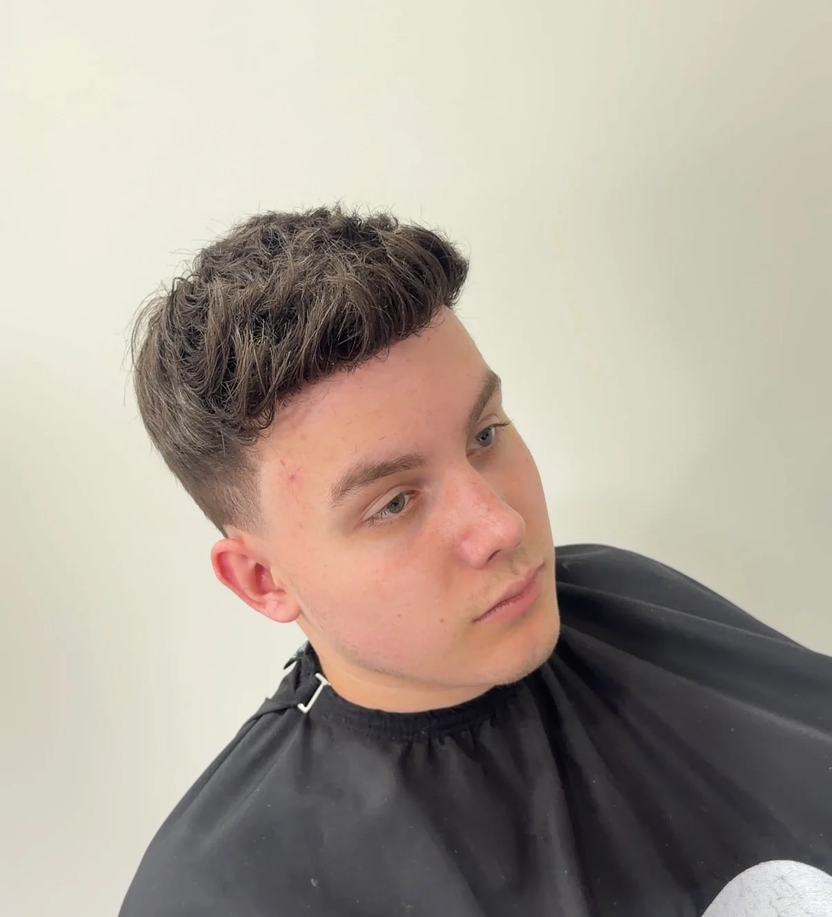 Client after hair replacement