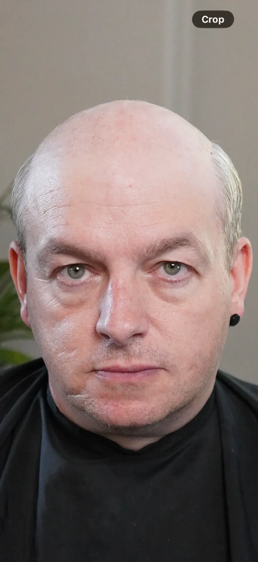 Client before hair replacement at Hair Repair Club